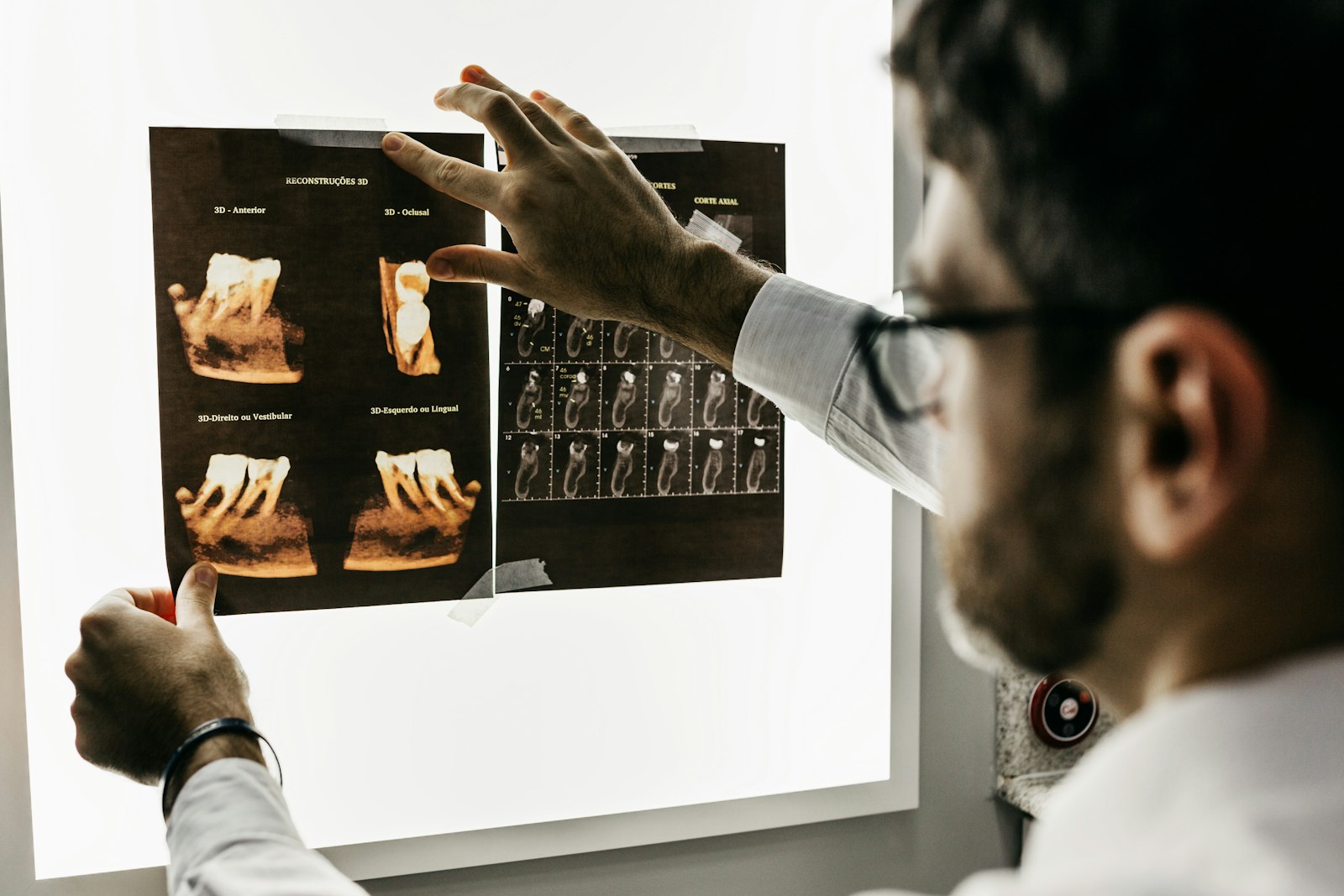 Digital dental scanner